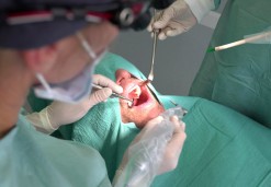 Zahnchirurgische Eingriffe - Zahnklinik OZ 95
