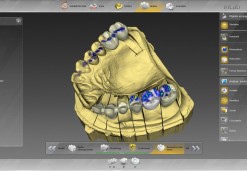 CEREC 3D PROTHETIK (CAD/CAM) - Zahnklinik OZ 95