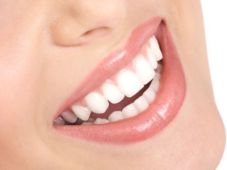 Dünne Porzellan-Zahnschalen (Veneers) für das perfekte Lächeln