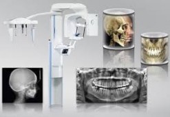 Digitales 3D CBCT-Röntgen